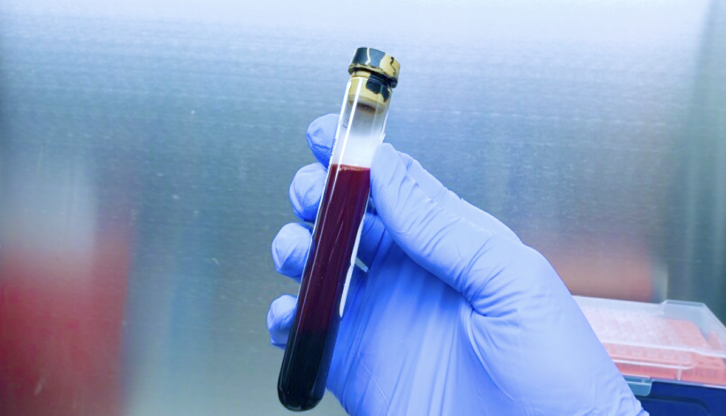 ColonAiQ_Website_HowToOrderTest_picture